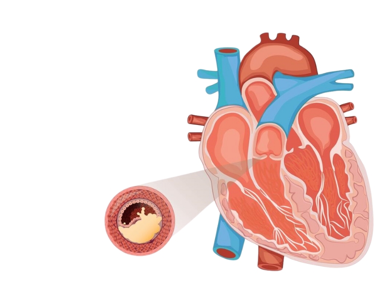Cách cải thiện sức khỏe tim mạch cho người cao tuổi - Bài tập và chế độ dinh dưỡng hợp lý