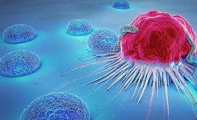 Ung thư là gì? Tìm hiểu nguyên nhân, triệu chứng và cách phòng ngừa