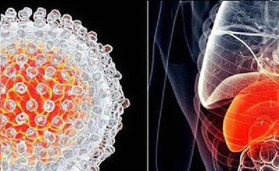 5 dấu hiệu dễ nhận biết của bệnh ung thư gan: đau bụng, vàng da, sụt cân, mệt mỏi kéo dài, bụng to